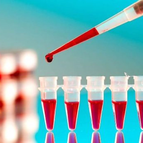 Testul Galleri identifică peste 50 de tipuri de cancer în fază incipientă